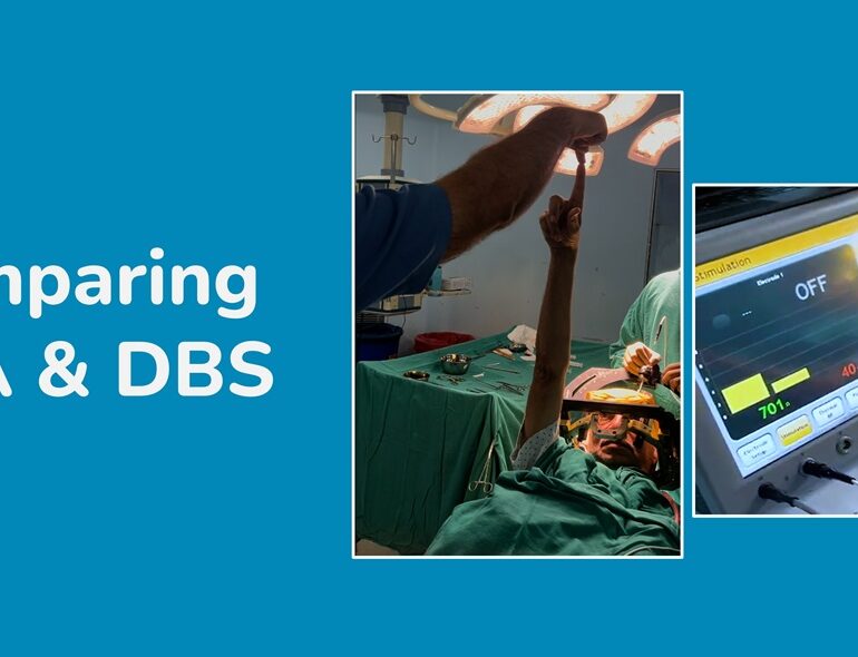 3_blog_rfa_dbs_comparison_banner