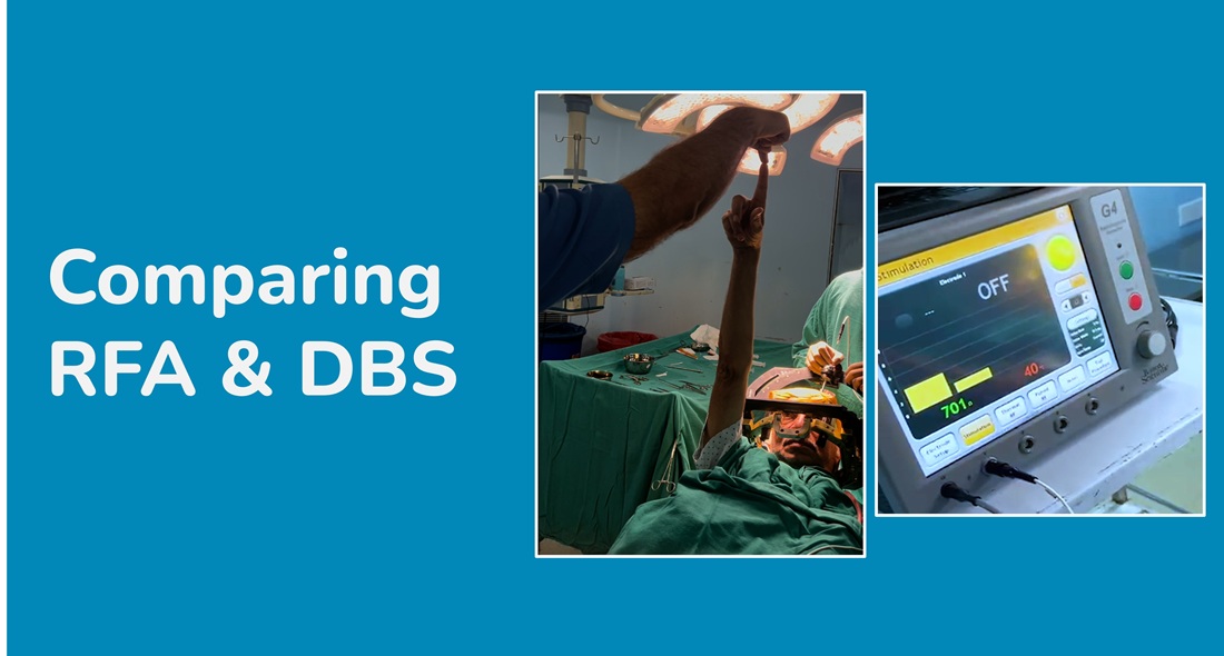 3_blog_rfa_dbs_comparison_banner