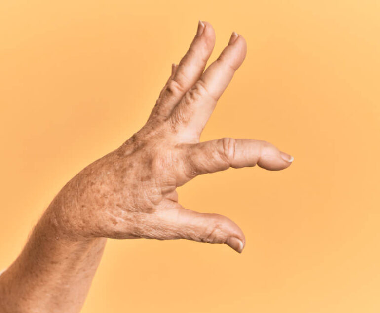 4_blog_what_is_dystonia_banner